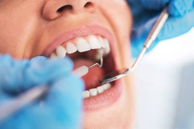 Teeth Cleaning Atlas Dental Toronto Dentist