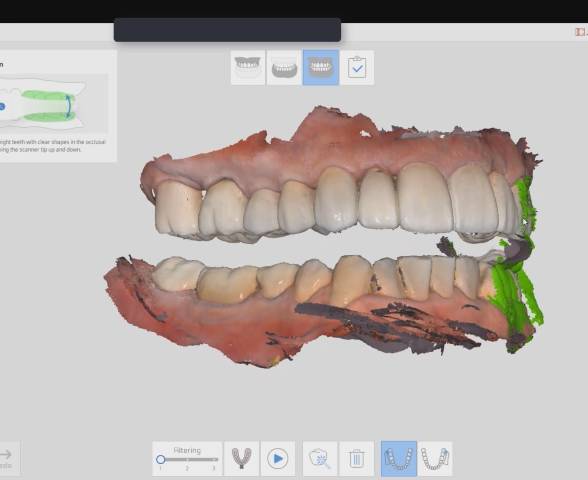 digital dentistry Toronto dentist