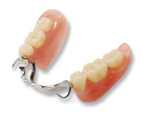 partial-dentures-toronto-dentist