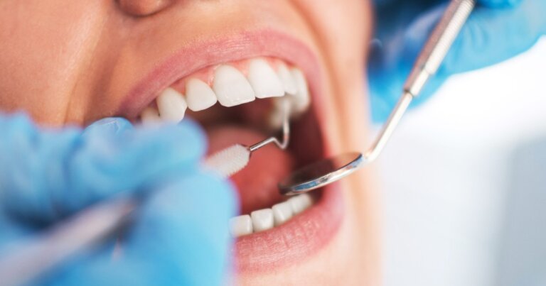 How Much is a Dental Cleaning in Toronto?  