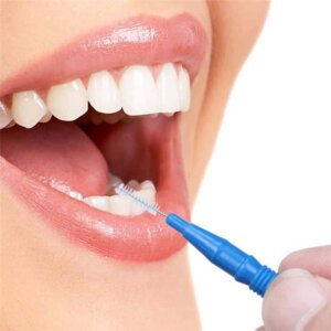 interdental-brush-toronto-dentist-near-me