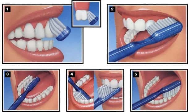 toothbrush-circuit-toronto-dentist-near-me