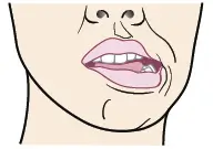 Active stretching of jaw muscles by moving lower jaw to the left