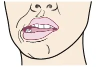 Active stretching of jaw muscles by moving lower jaw to the right