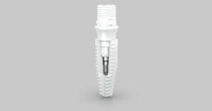 Nodent zirconia dental implant