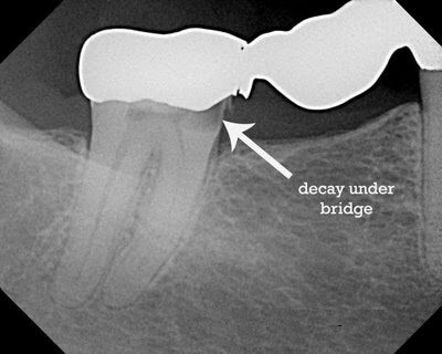 Cavity Under A bridge