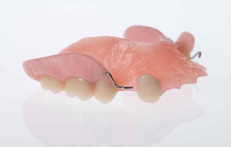 Acrylic partial denture