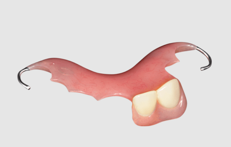 Acrylic partial denture