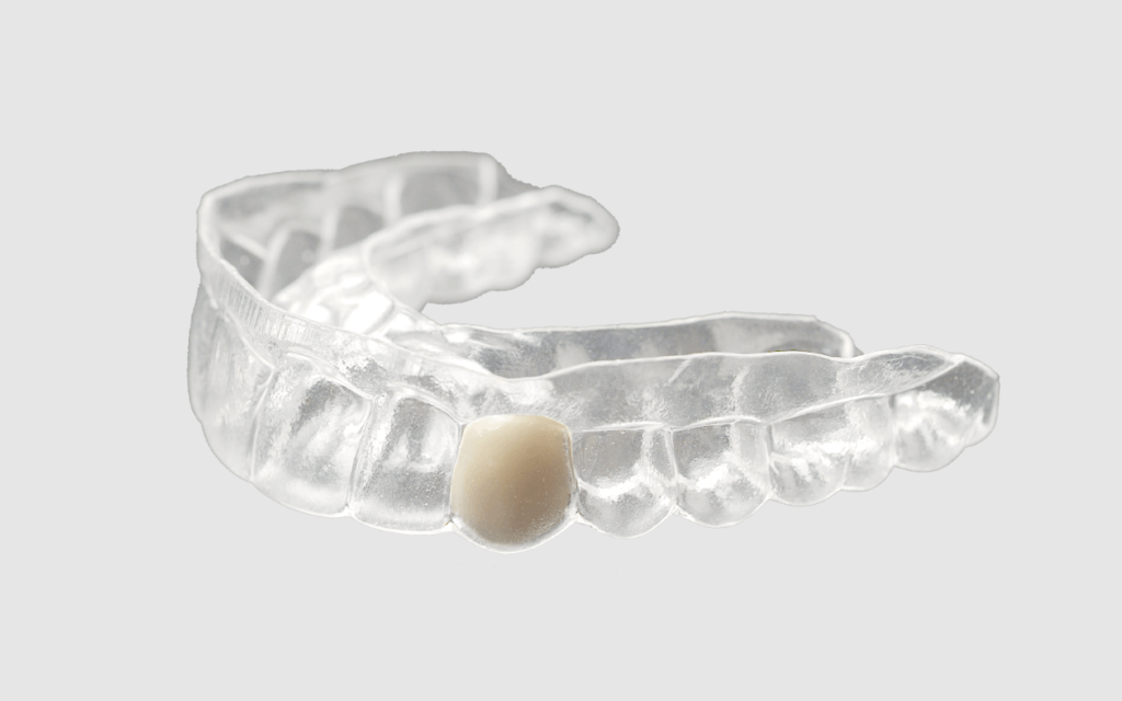 Denture services atlas dental toronto