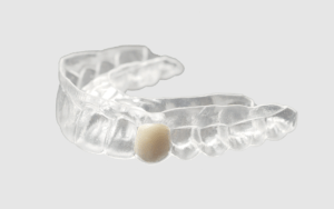 Essix denture