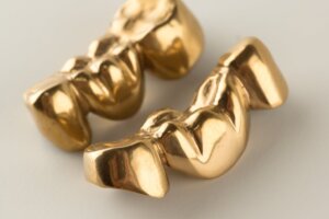 Gold dental crown