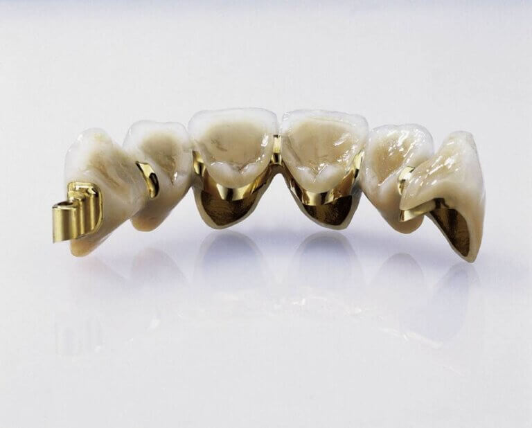 2 pièces 14k Plaqué Or Dents buccales, Dents unies, Top Tooth