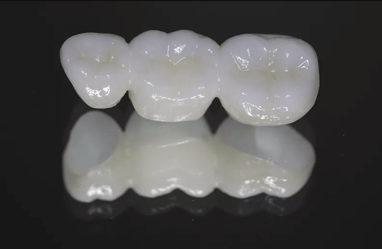 zirconia dental bridge