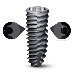 Hiossen dental implants