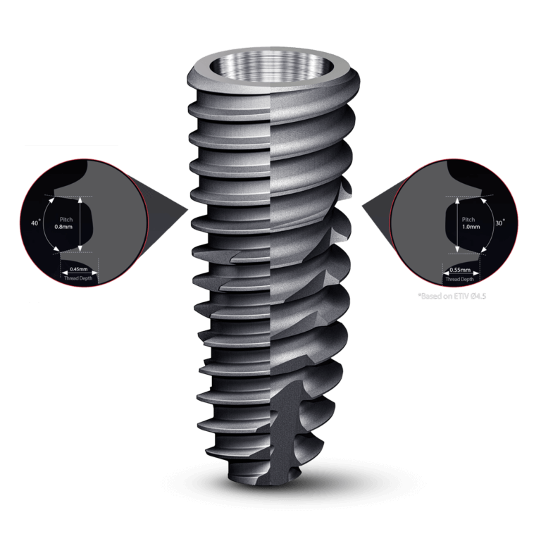 Hiossen dental implants