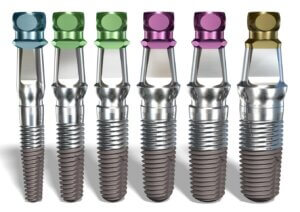 Implant Direct dental implants