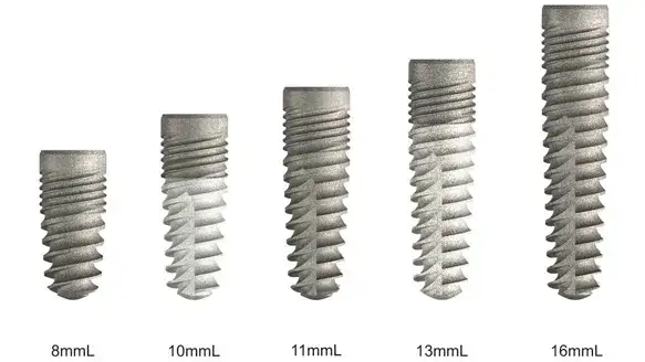 Implant Direct dental implants