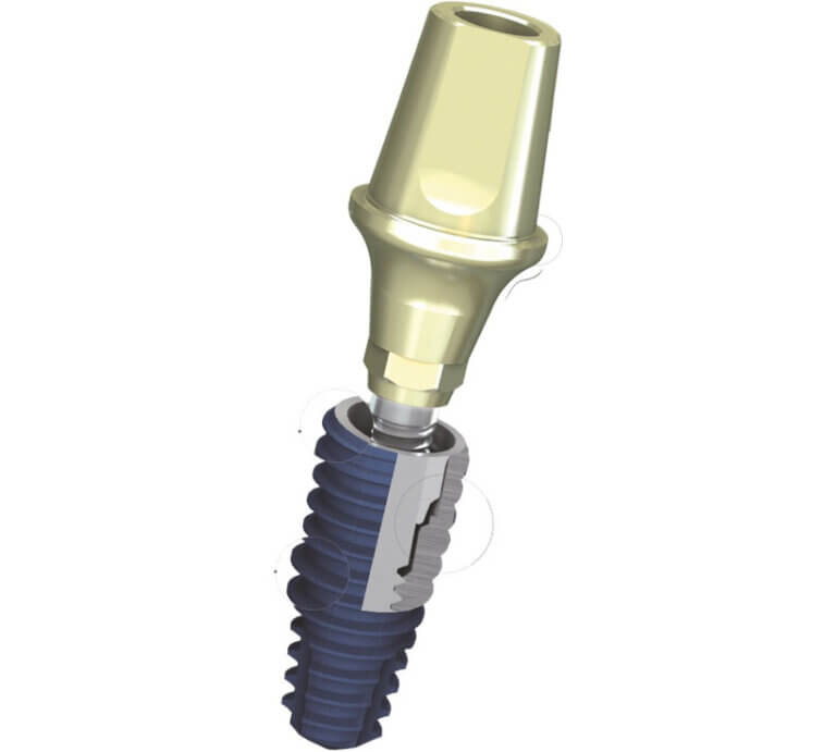 Megagen dental implants