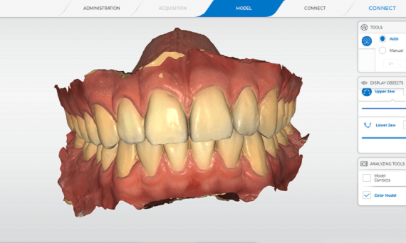 3D printed teeth models Toronto